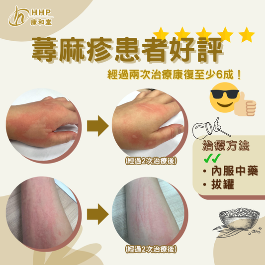 【受蕁麻疹長期困擾😟經過兩次治療康復至少6成!💪🏻】
