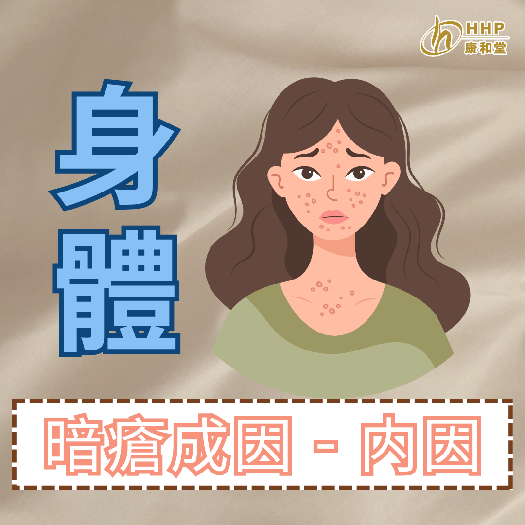 【暗瘡成因知多啲3——内因(身體篇)】 – 康和堂 HHPCL